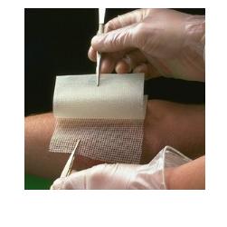 GARZA MEDICATA BACTIGRAS CON CLOREXIDINA ACETATO 0,5% 10X10CM 10 PEZZI - Farmadillo